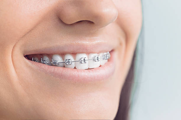 Laser Dentistry in Fort Dick, CA